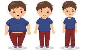 Obesitas pada Anak Tingkatkan Risiko Multiple Sclerosis
